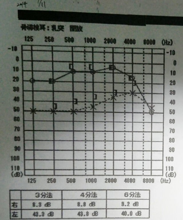 グラフの縦線で数値が低いほど聴こえる。横線はヘルツで右に行くほど音が高くなる