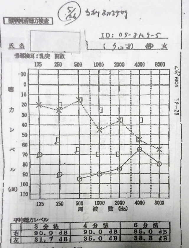 〇が右耳×が左。グラフの縦で下へ行くほど聴こえない。グラフの右へ行くほど高音が聞こえるか。